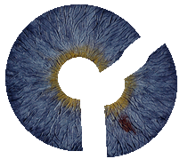 artificialiris-teilprothese.gif