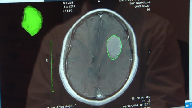 brain.jpg