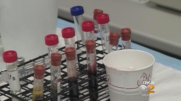 blood-test-vials 