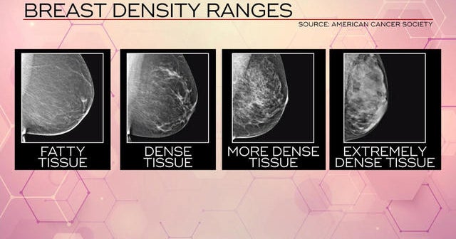 Mustang Mach 2 >> FDA proposes changes to breast cancer screening - CBS News Mustang Mach 2 >> FDA proposes changes to breast cancer screening - CBS News