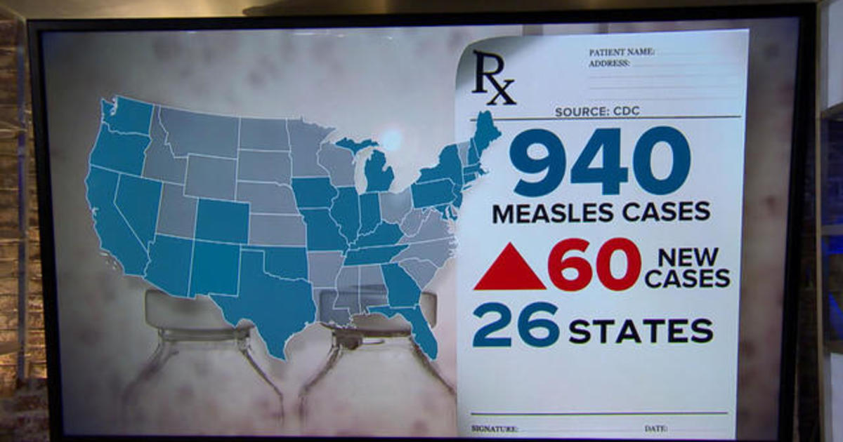 Measles outbreak continues to spread across the U.S. CBS News
