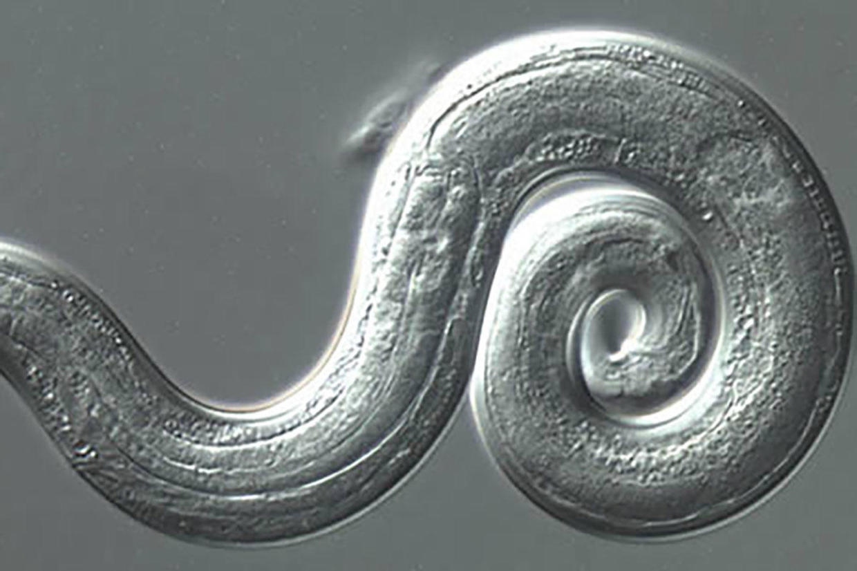 Rat lungworm disease: 3 more cases confirmed by Hawaii Health