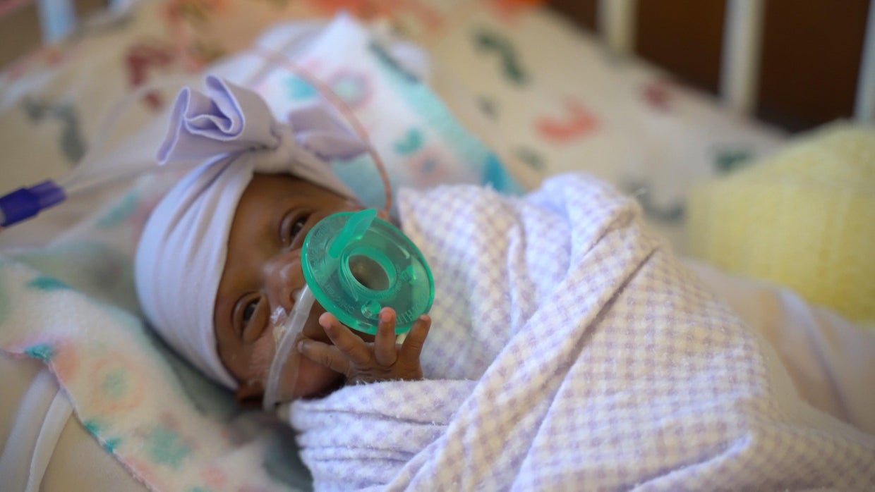 Saybie World's tiniest surviving micropreemie newborn girl revealed