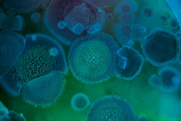 Aspergillus fumigatus