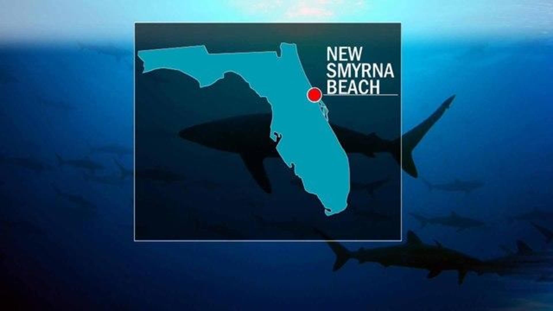 3 People Bitten By Sharks At Florida Beach Cbs News