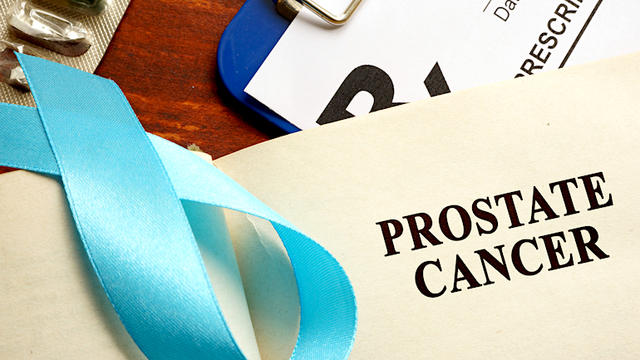 prostate-cancer-677870948.jpg 