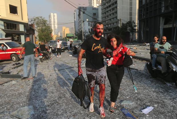 Beirut Lebanon Deadly Blast — Photos Aftermath Rubble Cbs News 1835