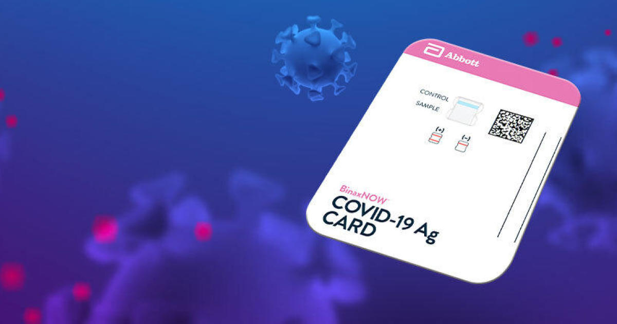 FDA approves $5 rapid coronavirus test that doesn't require special computer