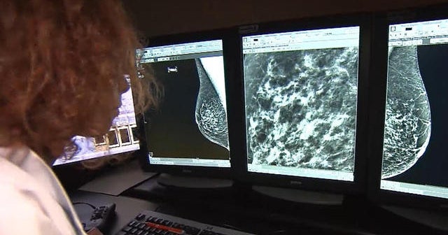 Great news for many breast cancer patients