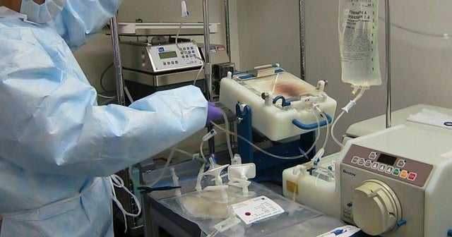 Gene therapy shows promise for some HIV patients