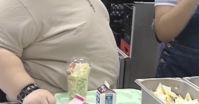 The high cost of childhood obesity