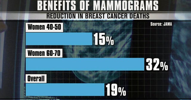 Mammograms benefits overstated, risks minimized, study says