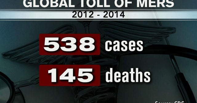 Second U.S. case of MERS confirmed in Florida