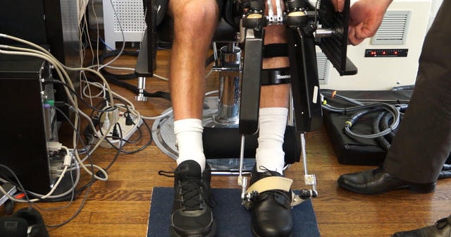 Robotics help runner rehabilitate after stroke