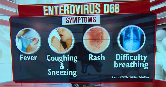 Child respiratory virus rapidly sweeping across country