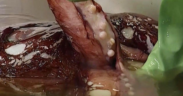 Colossal squid caught; autopsy performed