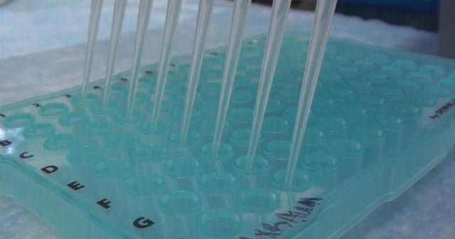 Major study identifies genes leading to autism