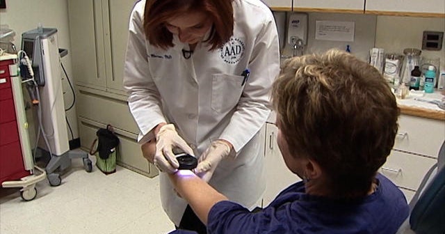 Skin cancer treatment becoming more expensive