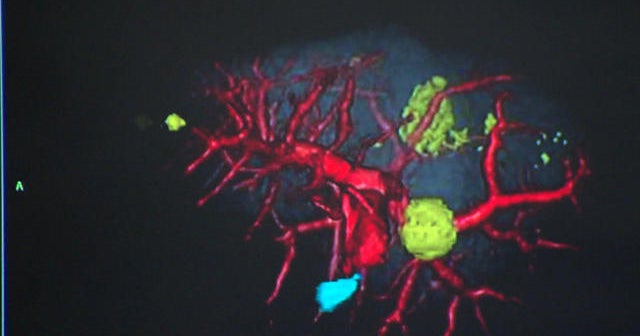 Can we really beat cancer?