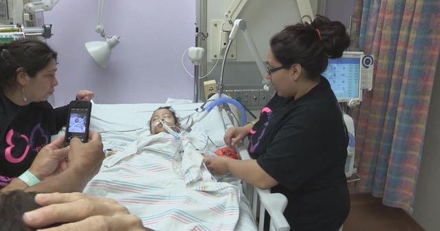 Conjoined twins successfully separated