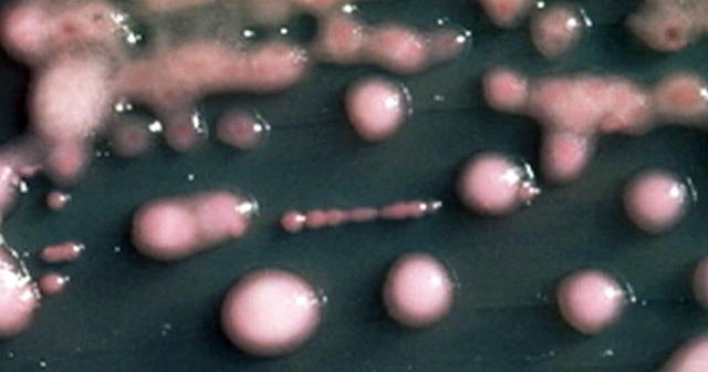 Superbug at UCLA Medical Center could have role in two deaths