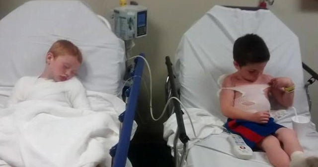 Extreme sunburn at daycare lands boys in the hospital