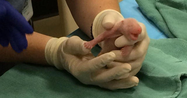 National Zoo gives a big welcome to newborn pandas