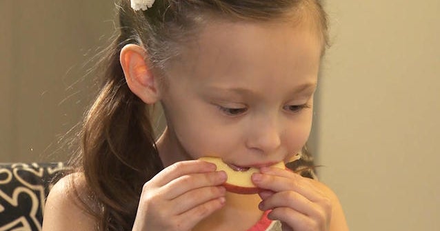 Whole fruit beats juice for kids, doctors say