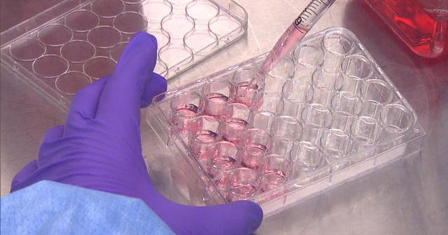 Why science can&rsquo;t find cure for common cold