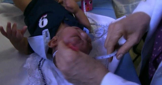 How concerned should U.S. be about Zika virus outbreak?