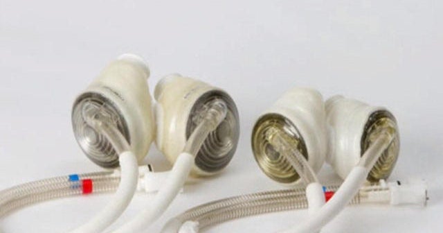 Could artificial hearts make donations obsolete?