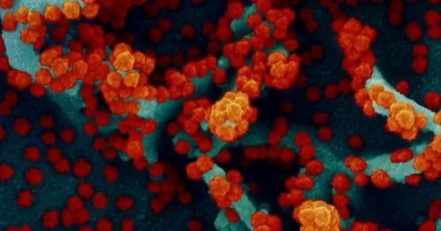 Surge in COVID cases tied to spread of U.K. variant Surge in COVID cases tied to spread of U.K. variant