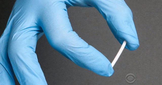 Buprenorphine implants; A new implant treatment for addicts