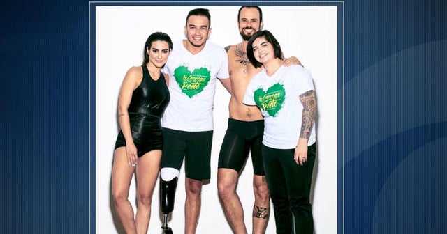 Vogue Brazil edits models to look disabled