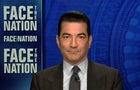 cbsn-fusion-gottlieb-says-us-seeing-hopeful-trend-thumbnail-700728-640x360.jpg 