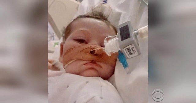 Trump, Pope Francis offer to help terminally ill baby in Britain