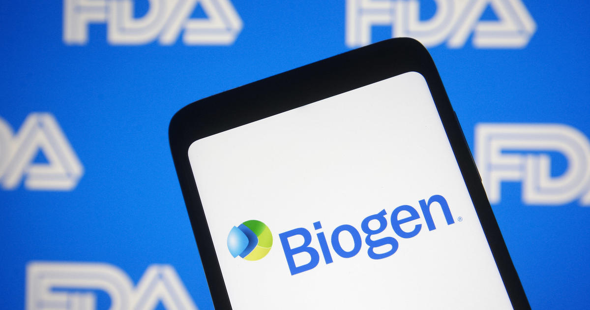 Biogen's new Alzheimer's drug comes with "serious cost concerns" for millions on Medicare