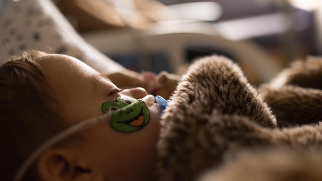 Toddler is sick in PICU with RSV and has IV and Oxygen 