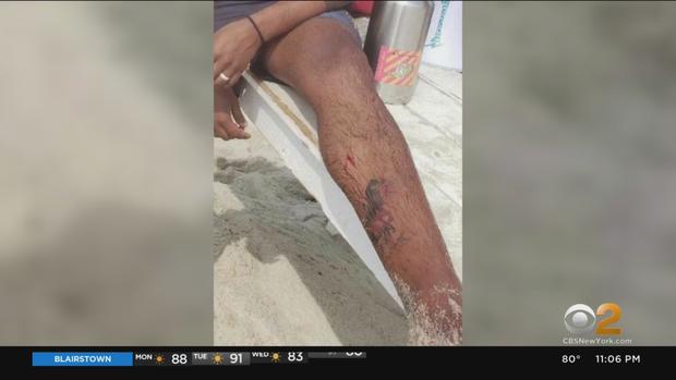 jones beach lifeguard possible shark bite deangelis 