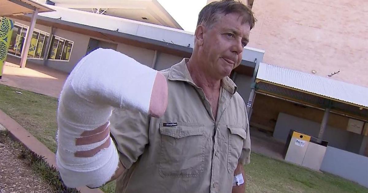 Wildlife tour operator survives attack by "jumping crocodile" in Australia