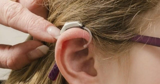 New FDA proposal would make hearing aids more affordable
