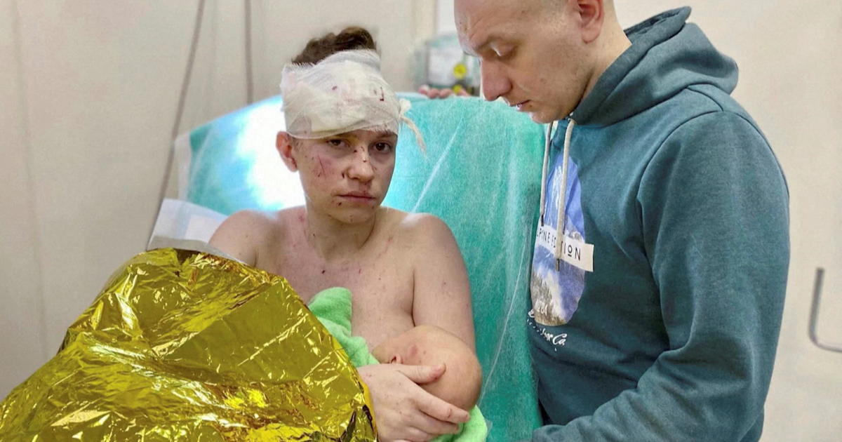 Ukrainian mother seriously wounded while shielding her 6-week-old baby from blast