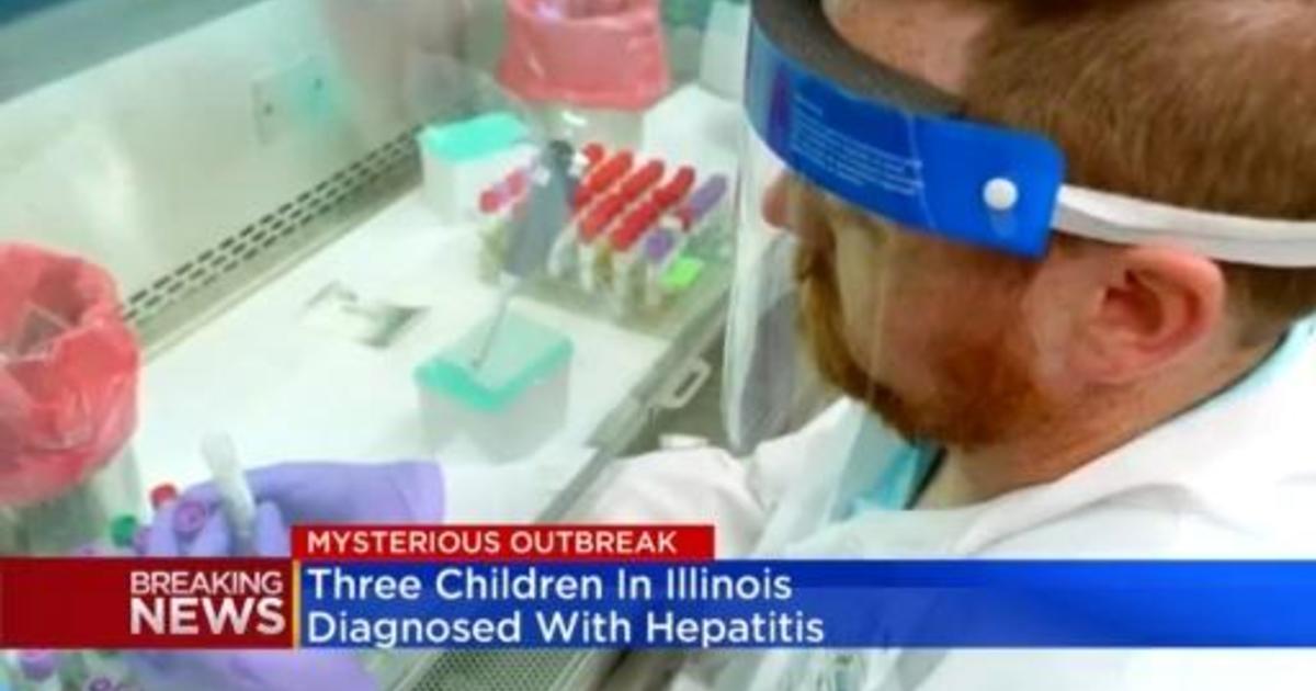 Illinois health officials warn that three children may develop severe hepatitis